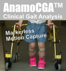 MarkerlessMotionCapture CGA ClinicalGaitAnalysis